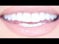 wedding photo - How To Get Really White Teeth For Cheap 